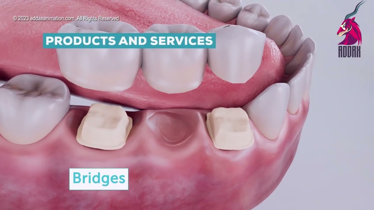 Dental treatment sequence produced for patient understanding and clinic use.