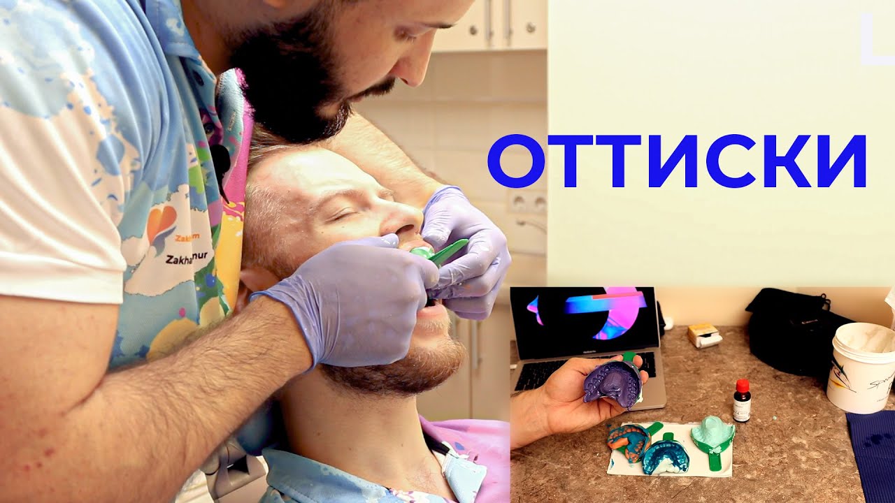 ОРТОПЕДИЧЕСКАЯ СТОМАТОЛОГИЯ 1 часть(ПОЛУЧЕНИЕ ТОЧНОГО ОТТИСКА) - YouTube