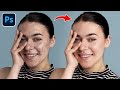 How to Remove Acne &amp; Blemishes in Photoshop (Easy Tutorial for Beginners)