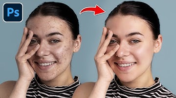 How to Remove Acne & Blemishes in Photoshop (Easy Tutorial for Beginners)