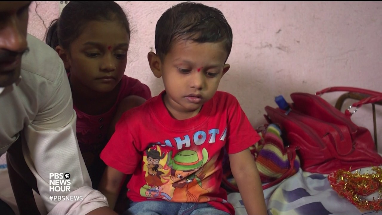 This Simple Correction For Clubfoot Is A Life Changer For Kids In India Youtube