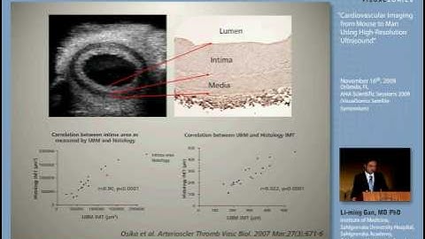 Cardiovascular Imaging from Mouse to Man Using High-Resolution Ultrasound