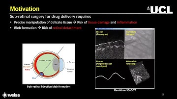 [IPCAI2023] Oral - PseudoSegRT: Efficient pseudo-labelling for intraoperative OCT segmentation