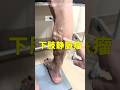 【血管のボコボコの正体】#shorts #雑学 #静脈瘤 #tiktok #tiktokvideo #tiktokviral