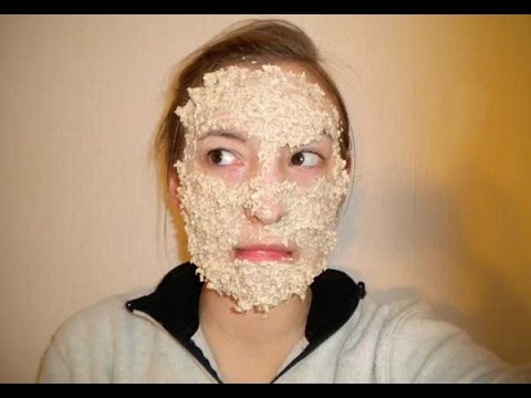 Face pack for acne at home