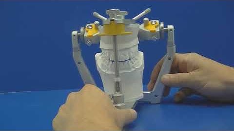 Technique: Fabricating an Anterior Deprogrammer