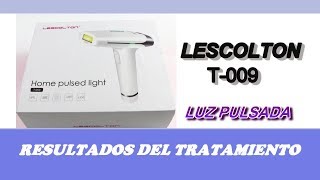 RESULTADO  DEL TRATAMIENTO CON LA DEPILADORA DE LUZ PULSADA LESCOLTON T-009