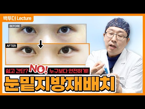 [눈밑지방재배치] 진짜 안전하냐고요? ※부작용 포함 다 알려드림※
