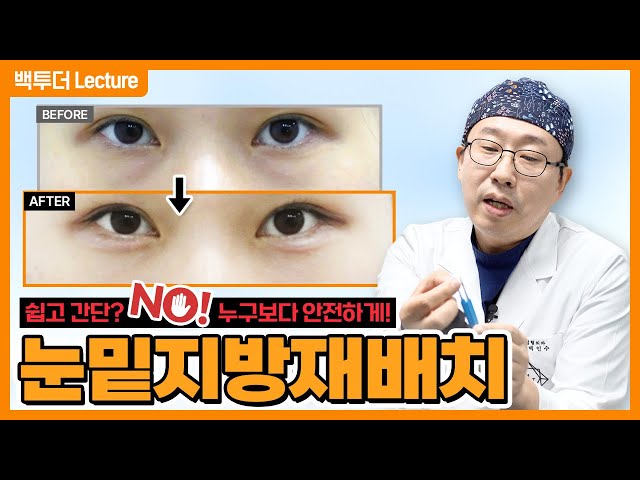 [눈밑지방재배치] 진짜 안전하냐고요? ※부작용 포함 다 알려드림※