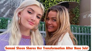 Sammi Sheen Reveals Journey of Her Recent Nose Job and Reflects on Cosmetic Surgery Choices