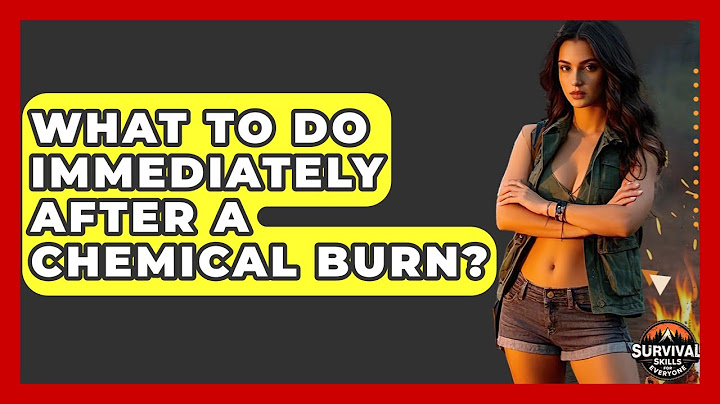 What To Do Immediately After A Chemical Burn? - Survival Skills for Everyone