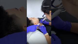 Láser CO2: Elimina lunares, verrugas y acrocordones de forma segura y sin cicatrices en Lima