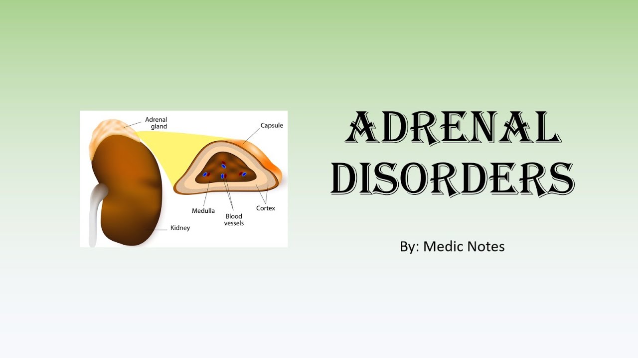 Adrenal disorders - Cushing's syndrome, Conn's syndrome, Addison's ...