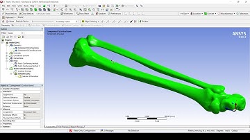Tibia fibula talus and calcaneus 3D model for finite element analysis (Buy)