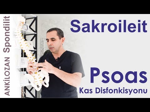 Sakroileit Oluşumunda Psoas Kas Disfonksiyonu - Sağlıklı Bilgi - Dr. Ceyhun Nuri