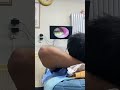 耳垢そうじ/耳が痒くなった鼓膜に付着した軟耳垢/ #shorts