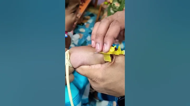 how to intravenous cannulation for 8 years child #ivcannulation #baby #viral #ivinsertiontechnique
