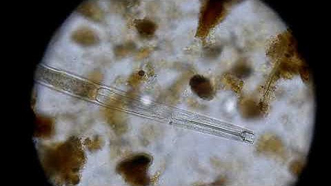 Predatory Nematode (@ 400x)