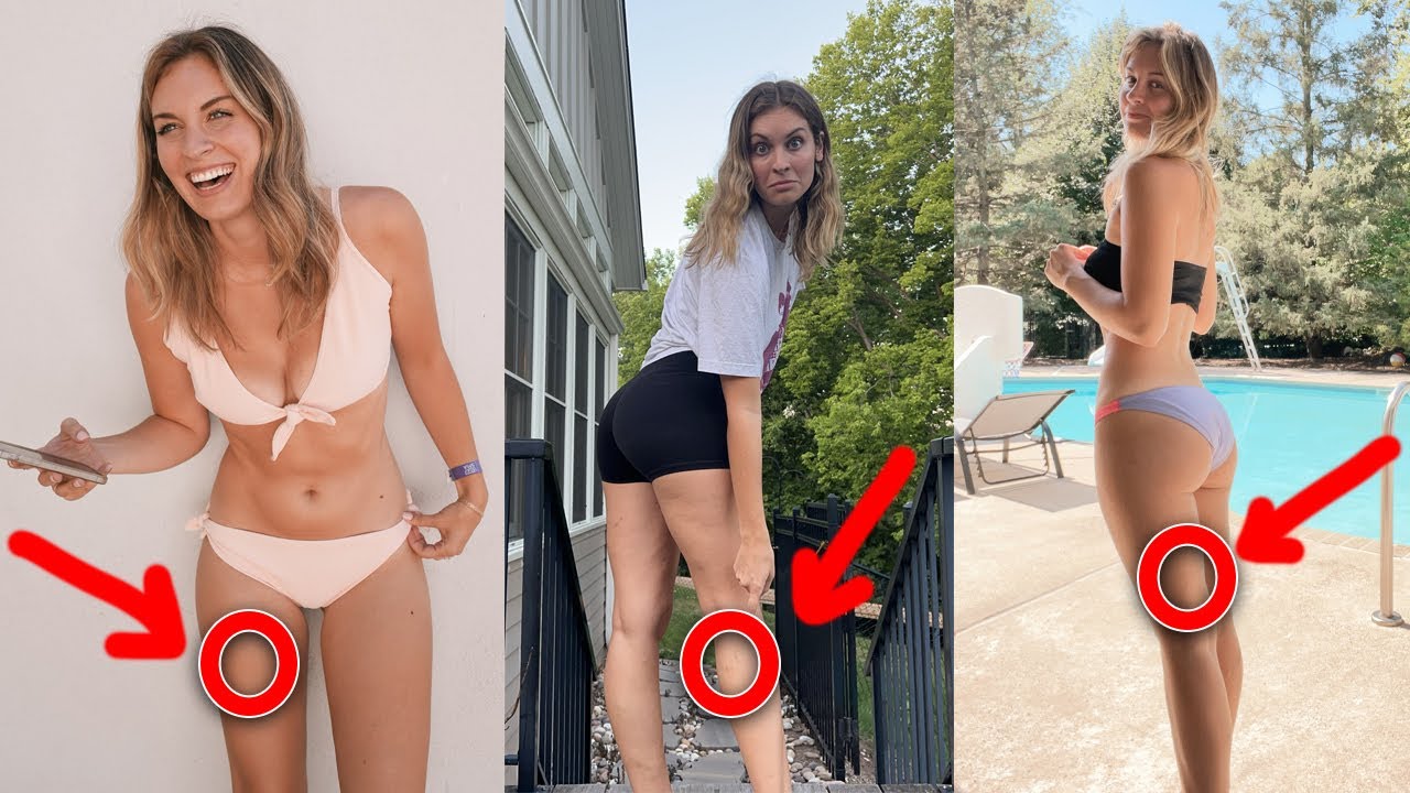 What's Wrong With Hannah's Legs? YouTube