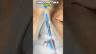 #анатомия  #медицина