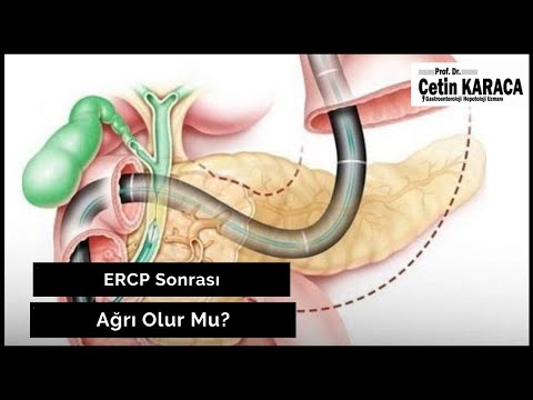 Video: E r c p nədir?