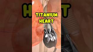 Bivacor Artificial Titanium Heart Technology Changing The Medical World