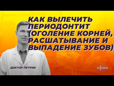 Как вылечить периодонтит( оголение корней, шатание и выпадение зубов). Перспективное исследование.