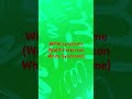 WPW Syndrome Wolff Parkinson White Syndrome Part One WPW Syndrome Wolff Parkinson White Syndrome Part One