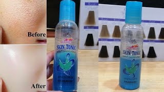 Soft Touch Skin Tonic | Best Skin Toner For oily skin | Soft Touch Toner Honest Review Uses price screenshot 1
