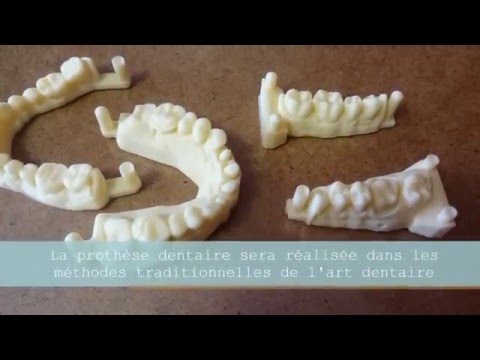 Imprimante 3D dentaire par dental labo mulhouse com