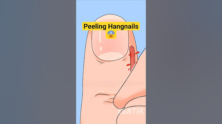 Peeling the WORST Hangnail Ever #satisfying #shorts #funnyanimation