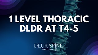 1 Level DLDR Laser Endoscopic Surgery in the Thoracic Spine