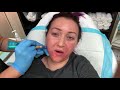 Middle of video