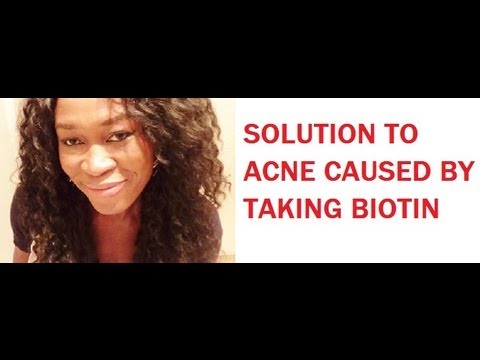 A SOLUTION TO BIOTIN CAUSING ACNE BREAKOUTS