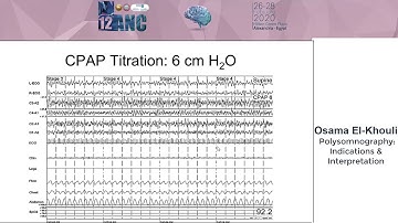 01 Polysomnography Indications   Interpretation