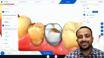 Tip of the Day: Screw Hole