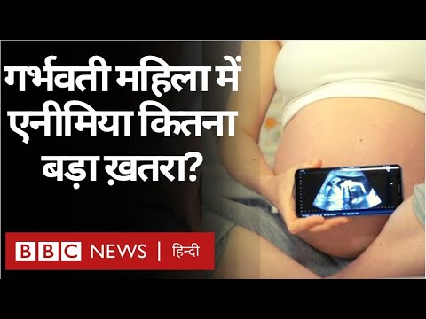 प्रेगनेंसी में कैसे सोये जिससे शिशु का विकास होगा सही | जानें गर्भावस्था में सोने का सही तरीका