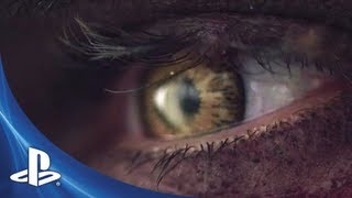 Tumnagel