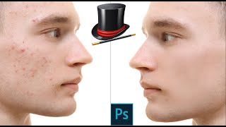 How to acne removal from the face  | photoshop screenshot 4