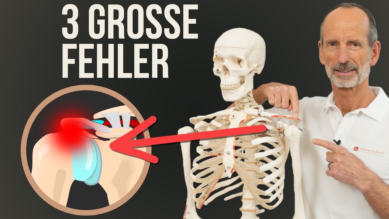 Schulter Impingement lösen ❌ Mache diese 3 Fehler NICHT!