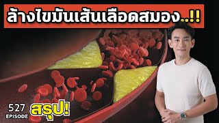 สรุปให้! เทคนิคล้างไขมันจากหลอดเลือดสมอง ใน 3 เดือน | หมอท๊อป คลิปสรุป 460