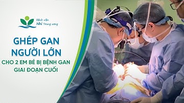 Ghép gan người lớn cho 2 em bé bị bệnh gan giai đoạn cuối