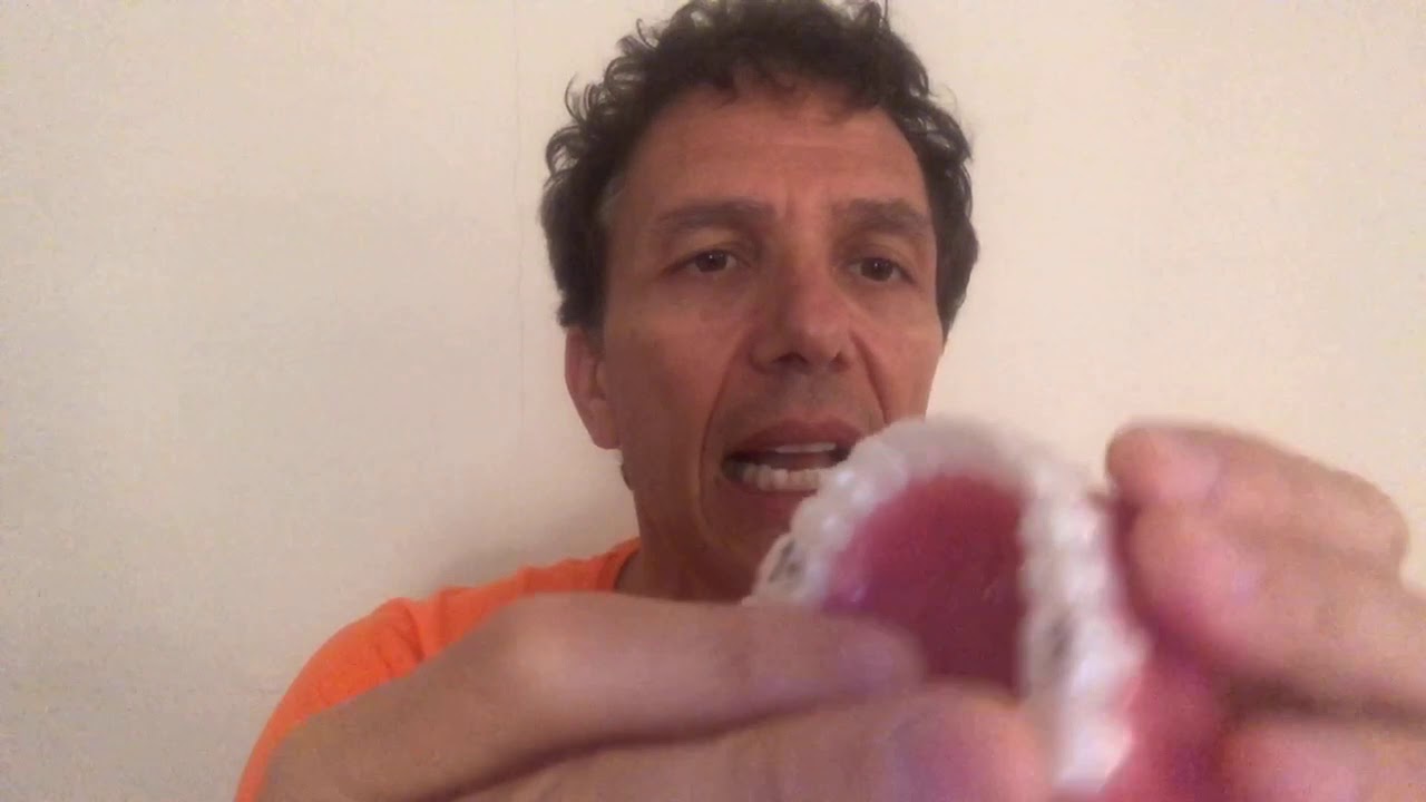 Apparecchio fisso o trasparente?