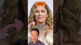 Vanessa Williams Plastic Surgery Analysis #medspa #filler #botox