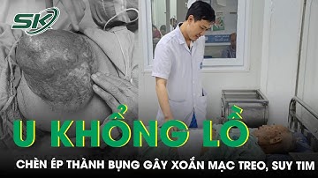 Xoắn Mạc Treo Ruột, Suy Tim Do Khối U Khổng Lồ Thành Bụng Chèn Ép  | SKĐS