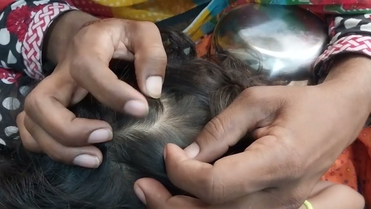 Nitpicking ASMR video 145