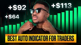 You'll NEVER Profit Trading Binary Options Until You Stop This ONE Mistake