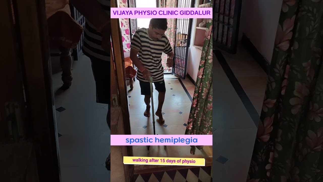 paralysis ( spastic hemiplegia ) recovered walking without support after 15 days of physio