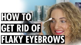 How to Get Rid of Flaky Eyebrows