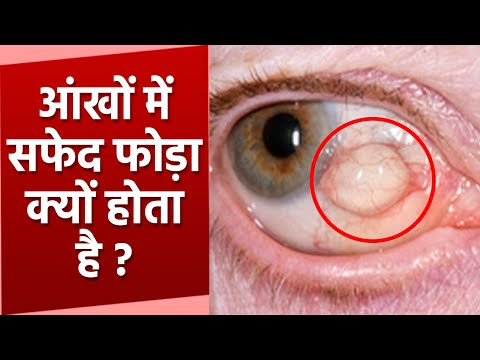 वीडियो: कुछ सांद्र सफेद क्यों होते हैं?